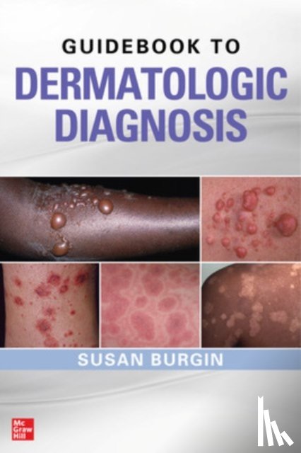 Burgin, Susan - Guidebook to Dermatologic Diagnosis