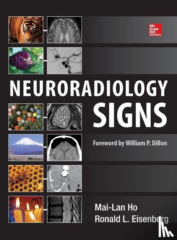 Ho, Mai-Lan, Eisenberg, Ronald - Neuroradiology Signs