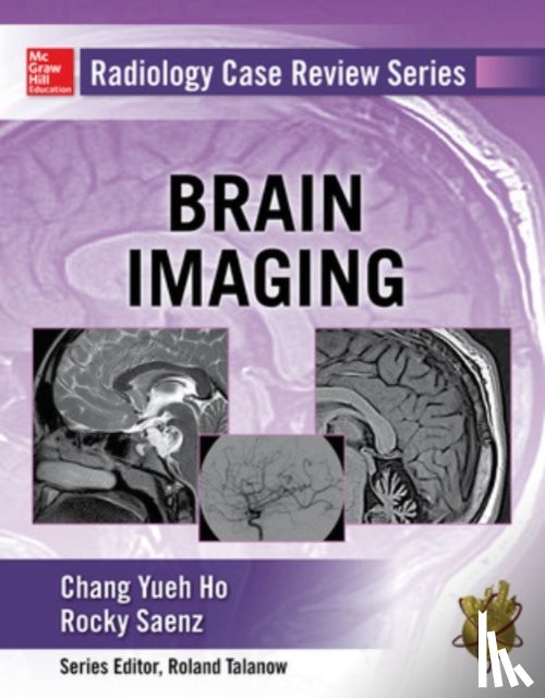 Ho, Chang, Saenz, Rocky - Radiology Case Review Series: Brain Imaging