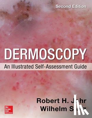 Johr, Robert, Stolz, Wilhelm - Dermoscopy: An Illustrated Self-Assessment Guide, 2/e