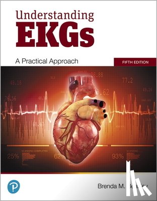 Beasley, Brenda - Understanding EKGs