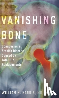 Harris, William H. (Alan Gerry Clinical Professor of Orthopaedic Surgery - Vanishing Bone