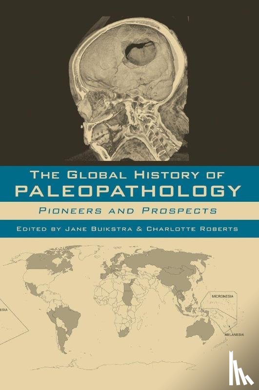  - The Global History of Paleopathology