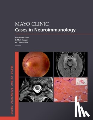 McKeon, Andrew (Professor of Laboratory Medicine & Pathology and of Neurology, Keegan, B. Mark (Professor of Neurology, Tobin, W. Oliver (Associate Professor of Neurology - Mayo Clinic Cases in Neuroimmunology