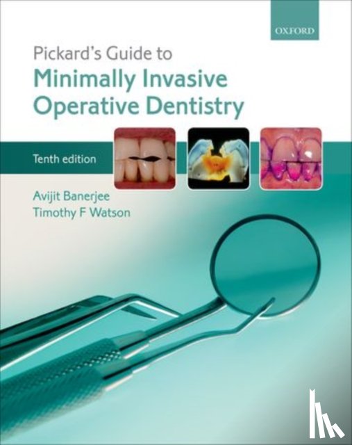 Banerjee, Avijit (Professor of Cariology & Operative Dentistry, Professor of Cariology & Operative Dentistry, King's College London Dental Institute, Guy's Dental Hospital, London, UK), Watson, Timothy F. (Professor of Biomaterials and Restorative - Pickard's Guide to Minimally Invasive Operative Dentistry