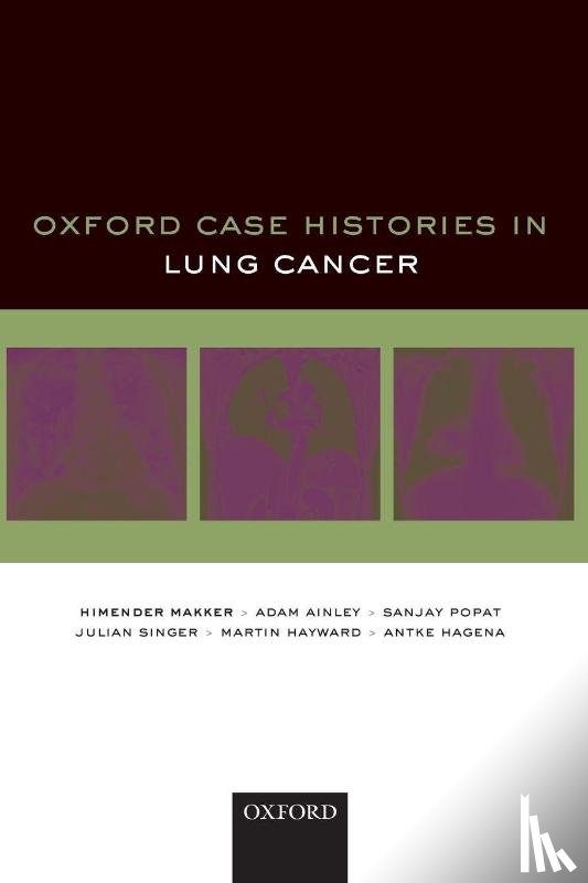 Makker, Himender K. (Consultant Respiratory Physician, Ainley, Adam (Specialist Registrar in Respiratory Medicine, Popat, Sanjay (Consultant Thoracic Medical Oncologist, Singer, Julian (Consultant Clinical Oncologist - Oxford Case Histories in Lung Cancer