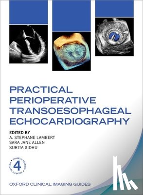 Lambert, A. Stephane - Practical Perioperative Transoesophageal Echocardiography