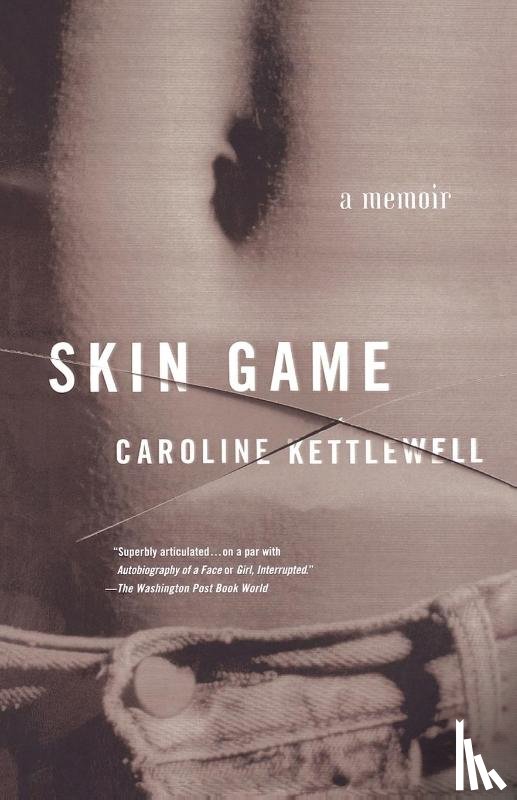 Caroline Kettlewell - Skin Game