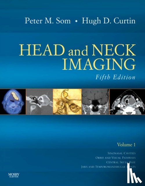 Som, Peter M. (Professor of Radiology, Curtin, Hugh D. (Professor of Radiology - Head and Neck Imaging - 2 Volume Set