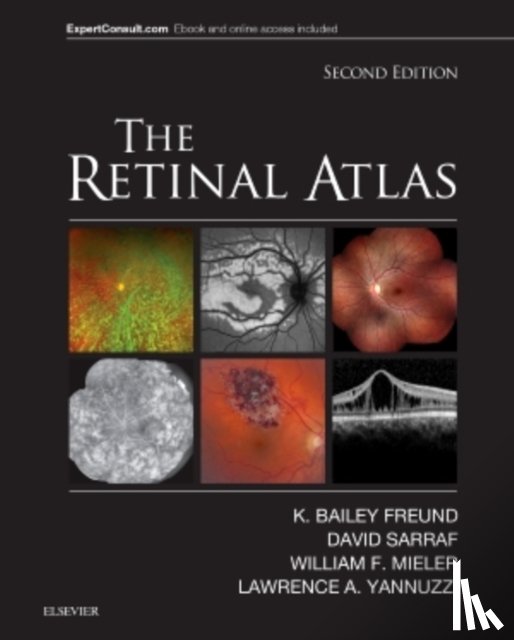 Freund, K. Bailey (Clinical Professor of Ophthalmology, Sarraf, David (Clinical Professor of Ophthalmology, Mieler, William F. (Cless Family Professor and Vice-Chairman, Yannuzzi, Lawrence A. (Vice-Chairman and Director of Retinal Services - The Retinal Atlas