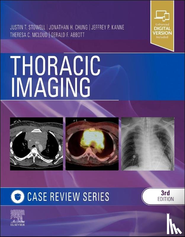 Stowell, Justin T., Chung, Jonathan H. (Section Chief, Kanne, Jeffrey P. (Professor and Chief of Thoracic Imaging, McLoud, Theresa C. (Associate Radiologist-in-Chief - Thoracic Imaging: Case Review