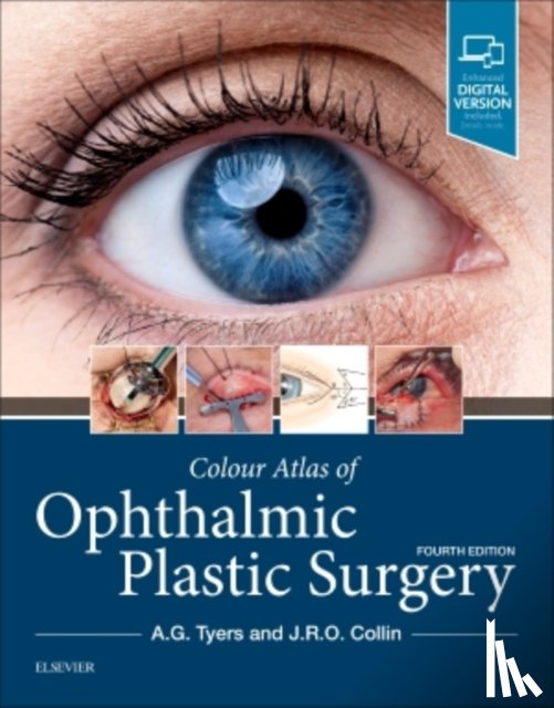 Tyers, Anthony G. (Consultant in Ophthalmic Surgeon, Collin, J. R. O. - Colour Atlas of Ophthalmic Plastic Surgery