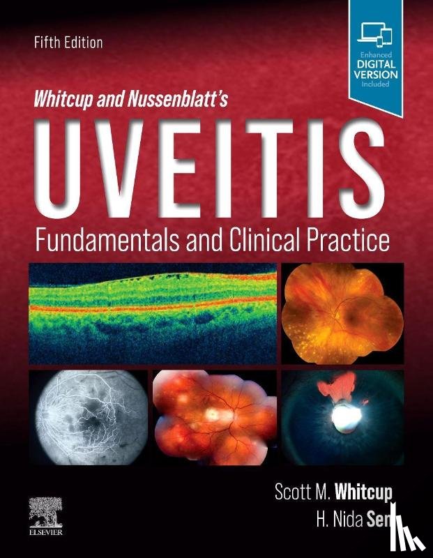 Whitcup, Scott M., Sen, H. Nida - Whitcup and Nussenblatt's Uveitis