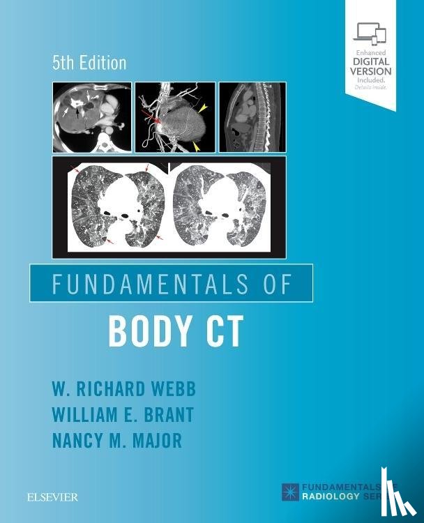 Webb, W Richard, Brant, Wiliam E. (Professor Emeritus, Major, Nancy M. (Professor of Radiology and Orthopedics - Fundamentals of Body CT