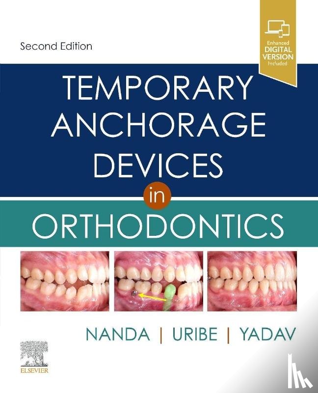  - Temporary Anchorage Devices in Orthodontics