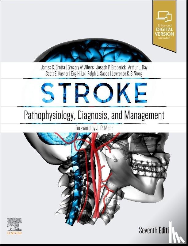  - Stroke