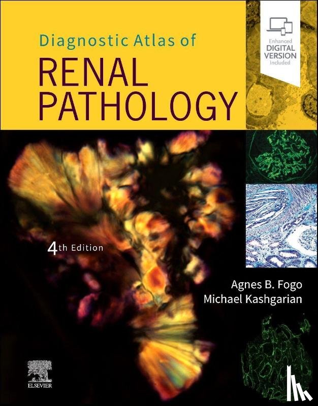Fogo, Agnes B. (Professor of Pathology, Kashgarian, Michael (Professor Emeritus of Pathology and Molecular - Diagnostic Atlas of Renal Pathology