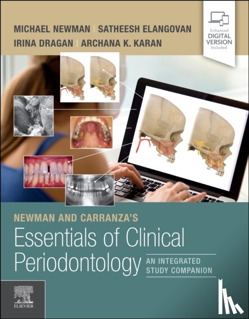  - Newman and Carranza's Essentials of Clinical Periodontology