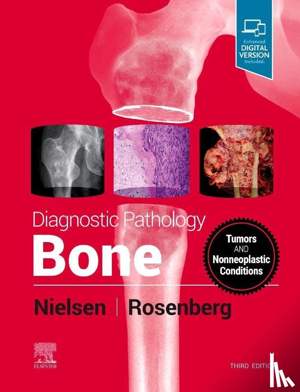 Nielsen, G. Petur (Pathologist, Rosenberg, Andrew E. (Professor of Pathology - Diagnostic Pathology: Bone