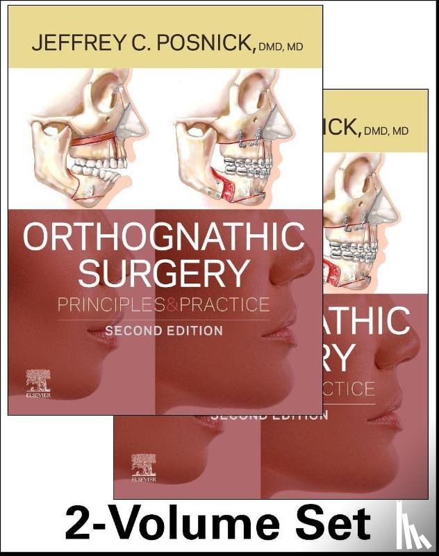 Posnick, Jeffrey C. - Orthognathic Surgery - 2 Volume Set