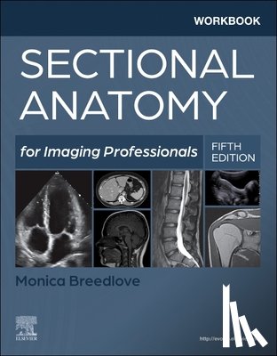 Breedlove, Monica - Workbook for Sectional Anatomy for Imaging Professionals
