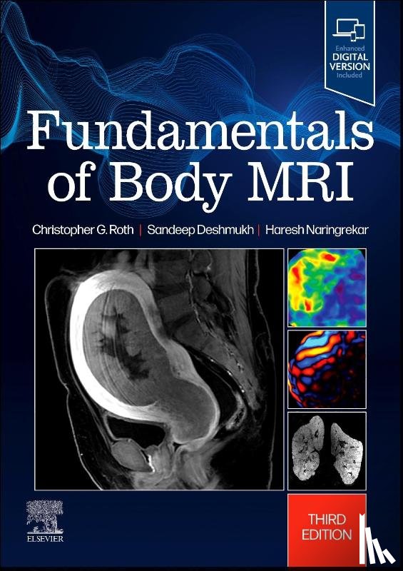 Roth, Christopher G. (Professor Interim Chair, Naringrekar, Haresh, Deshmukh, Sandeep (Clinical Professor Department of Radiology Thomas Jefferson University Philadelphia - Fundamentals of Body MRI