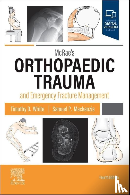 White, Timothy O, Mackenzie, Samuel P - McRae's Orthopaedic Trauma and Emergency Fracture Management