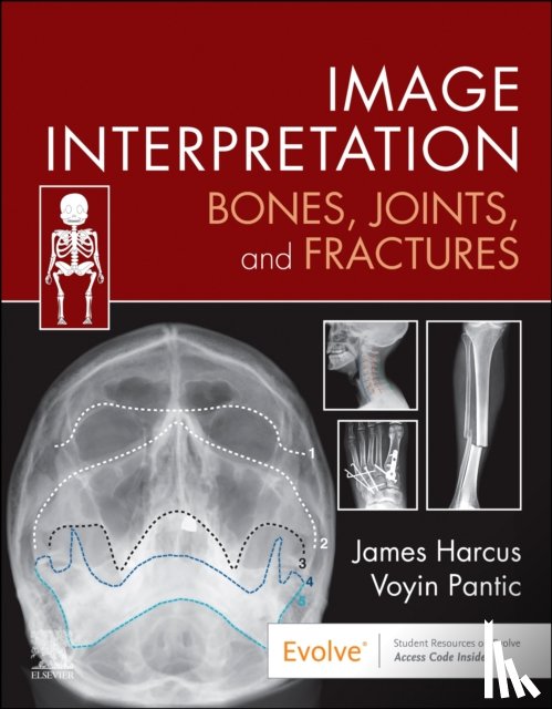 Harcus, James (Lecturer in Diagnostic Imaging, Pantic, Voyin - Image Interpretation: Bones, Joints, and Fractures
