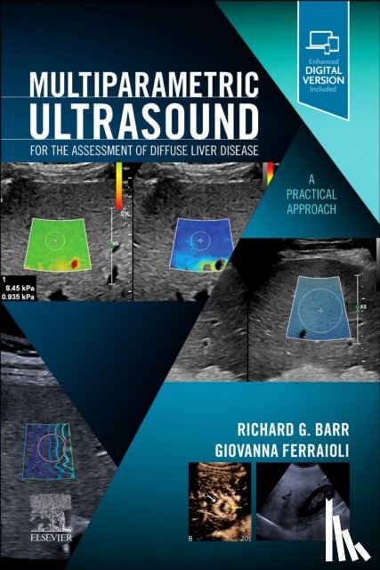  - Multiparametric Ultrasound for the Assessment of Diffuse Liver Disease