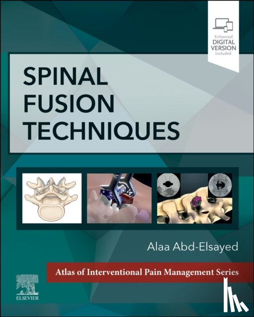 Abd-Elsayed, Alaa - Spinal Fusion Techniques