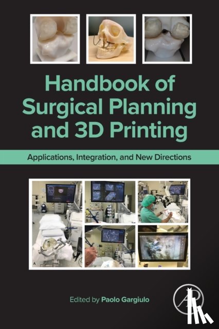  - Handbook of Surgical Planning and 3D Printing