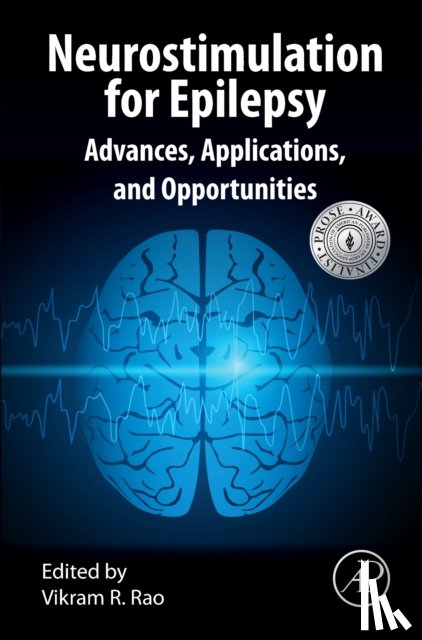  - Neurostimulation for Epilepsy