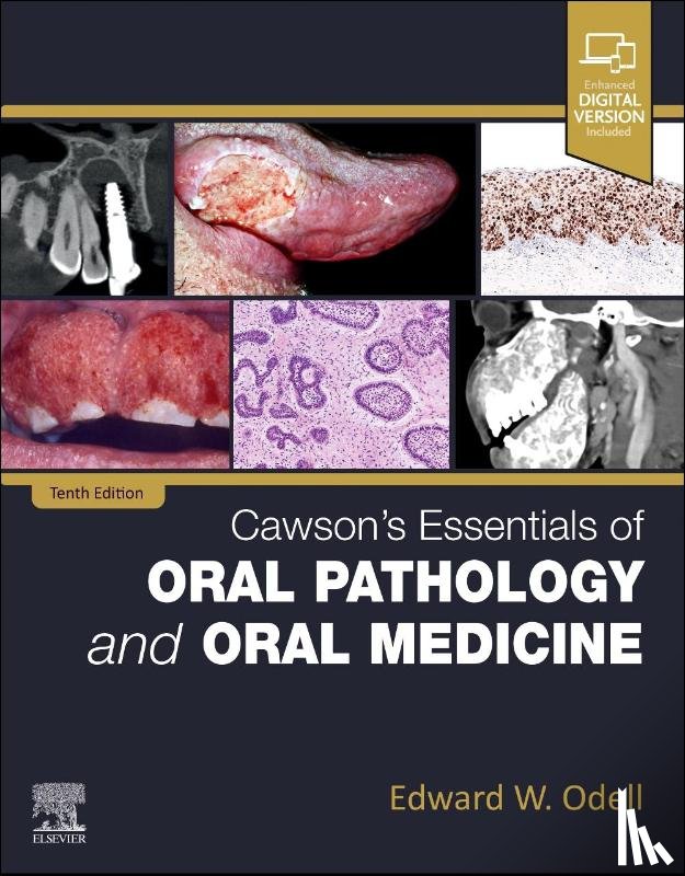 Odell, Edward W. (Professor of Oral Pathology and Medicine - Cawson's Essentials of Oral Pathology and Oral Medicine