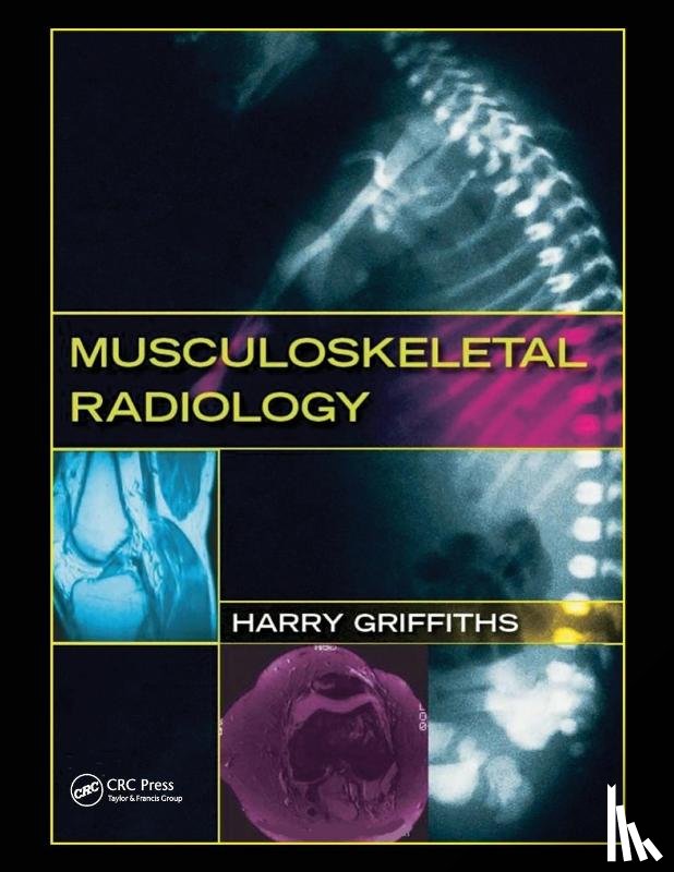 Griffiths, Harry - Musculoskeletal Radiology