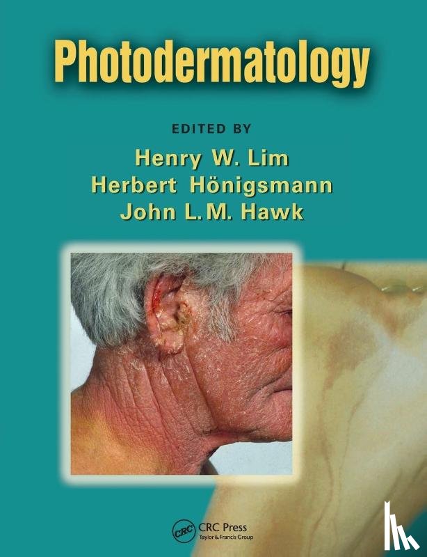  - Photodermatology