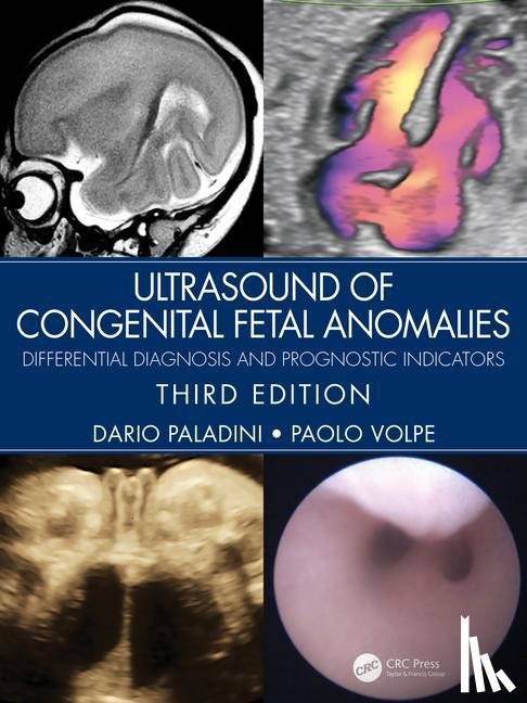 Paladini, Dario (Gaslini Children’s Hospital, Volpe, Paolo - Ultrasound of Congenital Fetal Anomalies