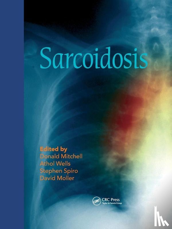  - Sarcoidosis