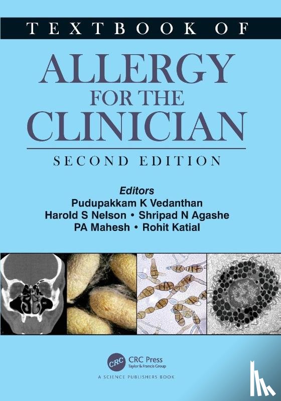  - Textbook of Allergy for the Clinician