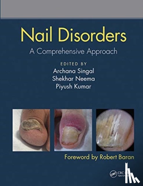  - Nail Disorders