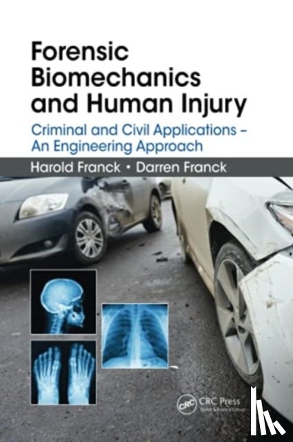 Franck, Harold, Franck, Darren - Forensic Biomechanics and Human Injury