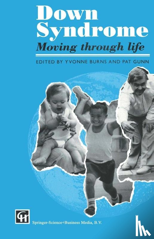 Gunn, Yvonne Burns and Pat - Down Syndrome