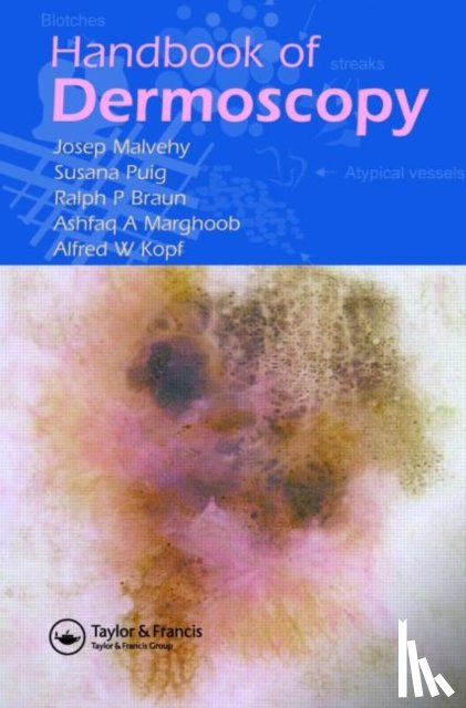Malvehy, Josep (Hospital Clinic, Braun, Ralph P., Puig, Susana (Hospital Clinic, Marghoob, Ashfaq A. (Memorial Sloan-Kettering Cancer Center - Handbook of Dermoscopy