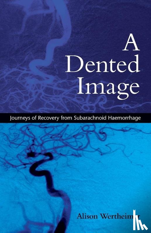 Wertheimer, Alison - A Dented Image