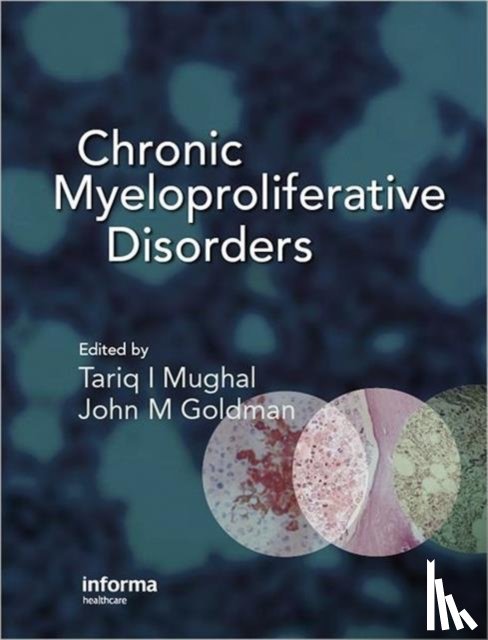  - Chronic Myeloproliferative Disorders