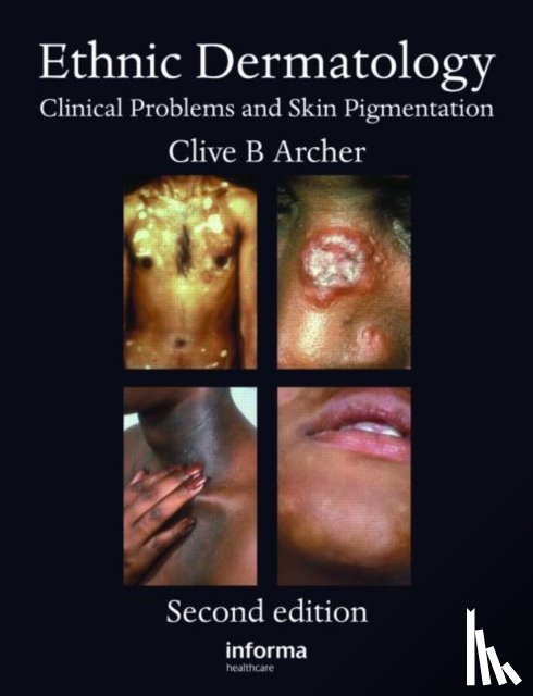  - Ethnic Dermatology