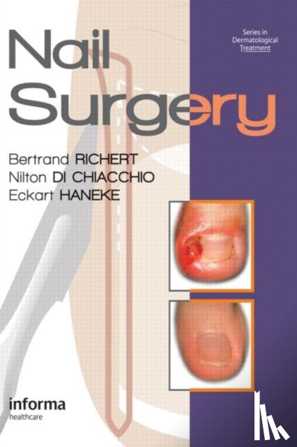 Richert, Bertrand (Clinical Professor, Di Chiacchio, Nilton (Head of Dermatology Clinic, Haneke, Eckart (University of Berne - Nail Surgery