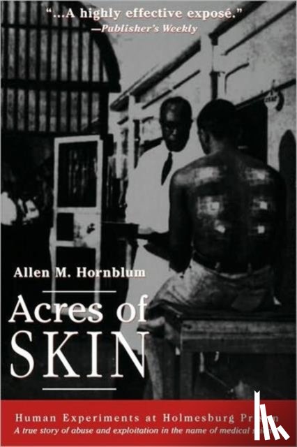 Hornblum, Allen M. - Acres of Skin
