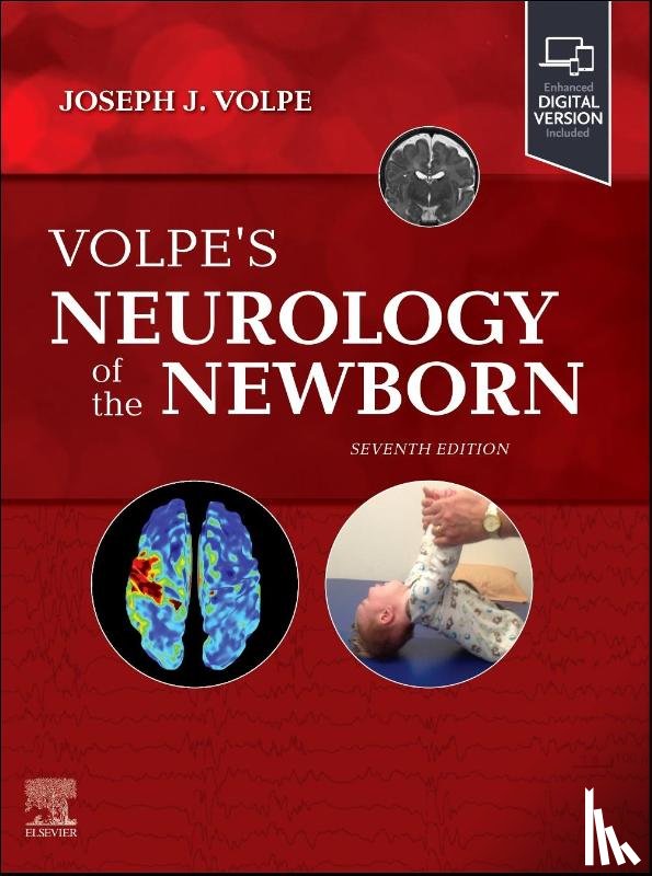  - Volpe's Neurology of the Newborn