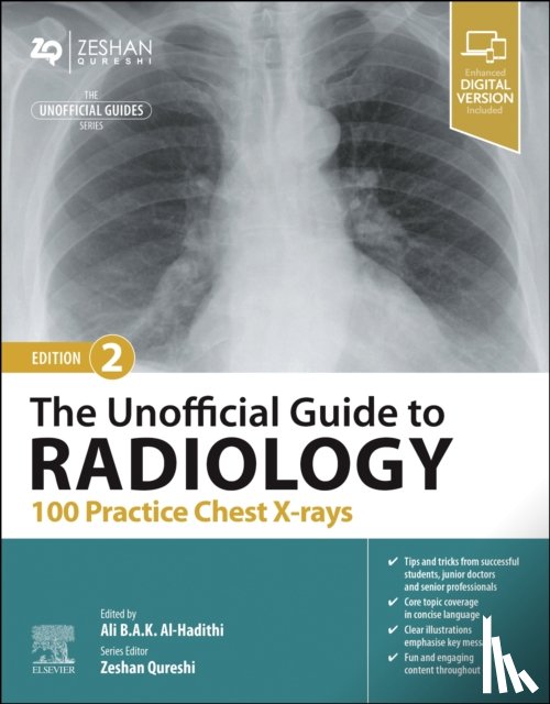  - The Unofficial Guide to Radiology: 100 Practice Chest X-rays