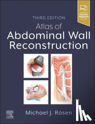  - Atlas of Abdominal Wall Reconstruction